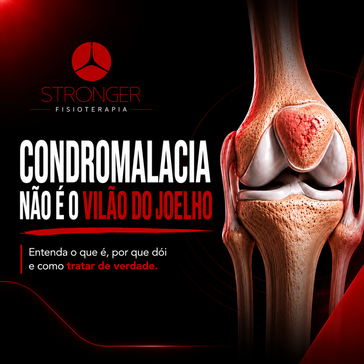 Conteúdo Stronger Fisioterapia